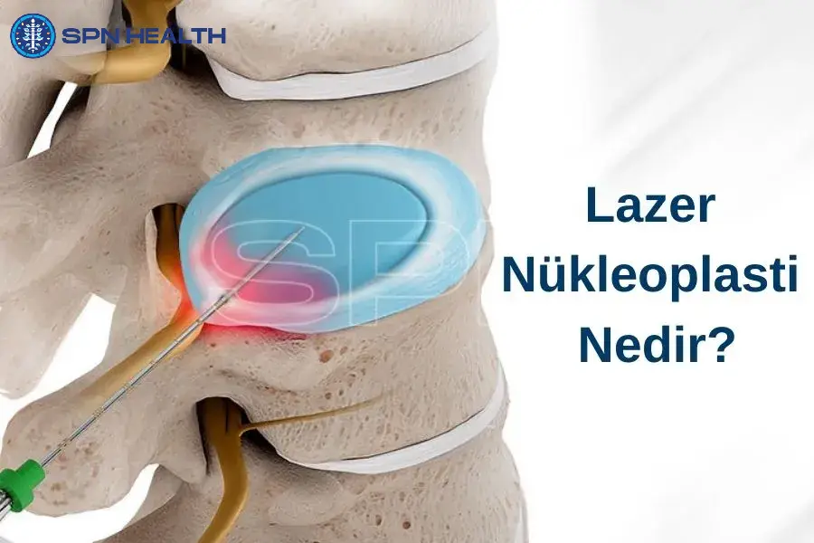 nukleoplasti-nedir-900x600-1.webp