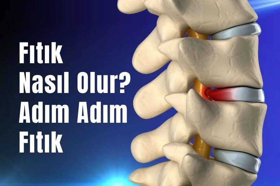 fıtık nasıl olur