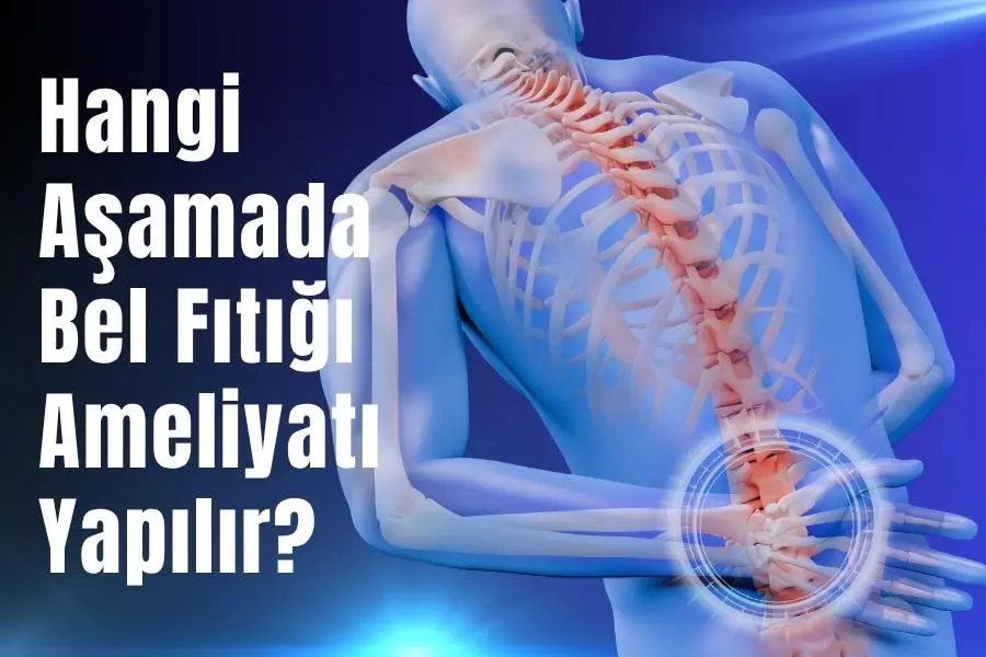Hangi aşamada bel fıtığı ameliyatı yapılır?