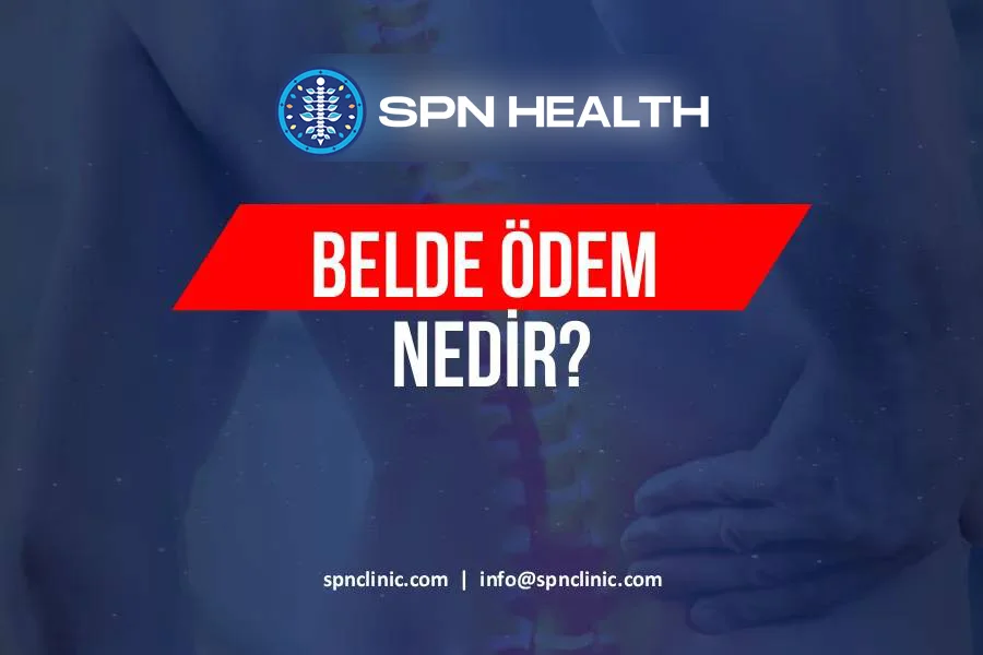 belde-odem-nedir-900x600-2.webp