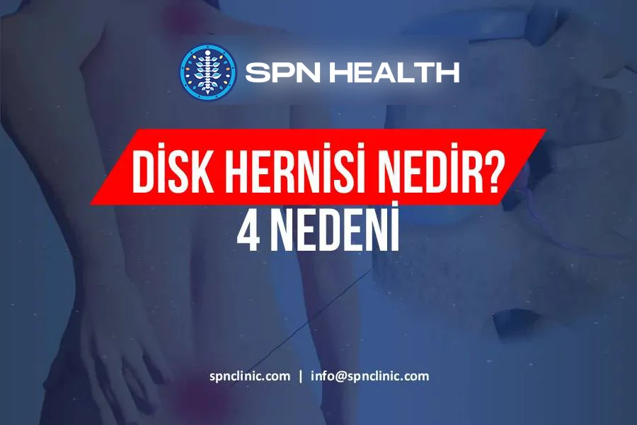 disk-hernisi-nedir-900x600-2.webp
