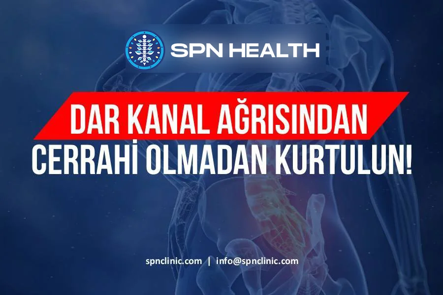dar-kanal-agrisindan-cerrahi-olmadan-kurtulun-900x600-1-1.webp
